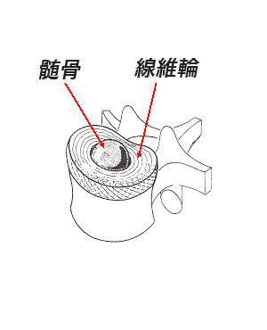 腰痛症